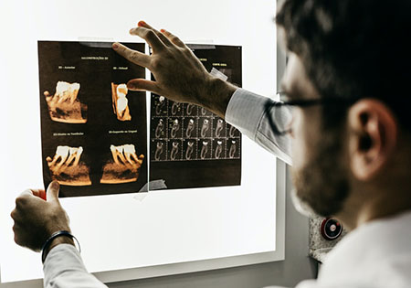 3D CBCT röntgen